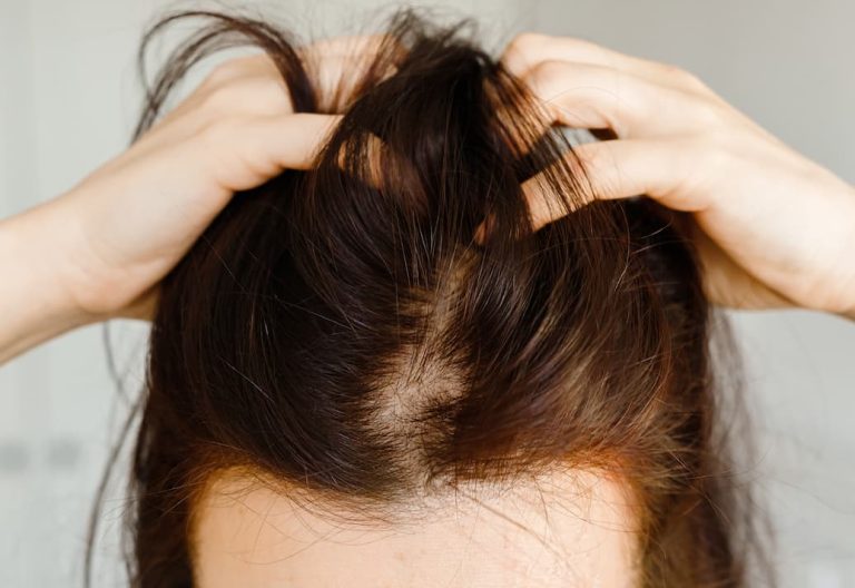 J'ai un énorme nœud dans les cheveux