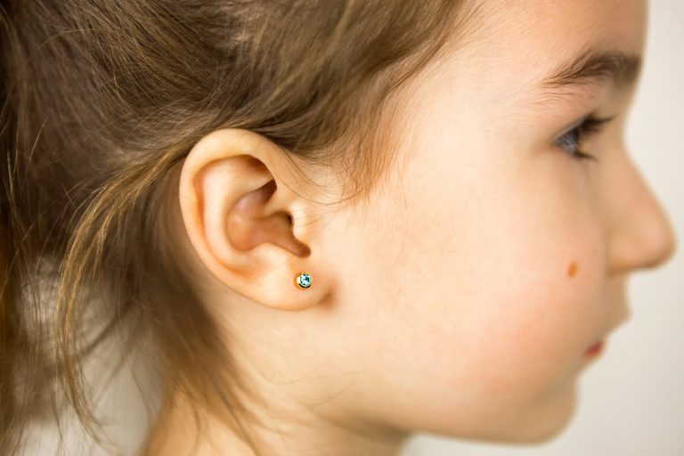 Peut-on garder les boucles d'oreilles médicales ? Tout ce qu'il faut savoir